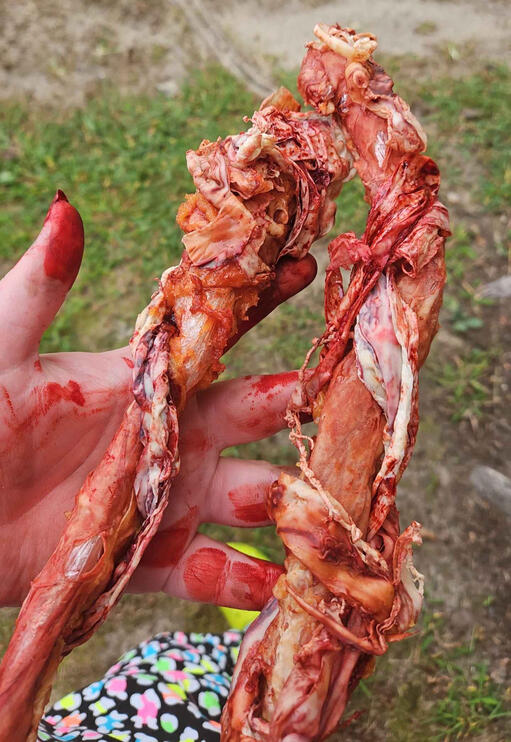 Intestines