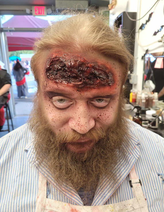 Forehead Wound